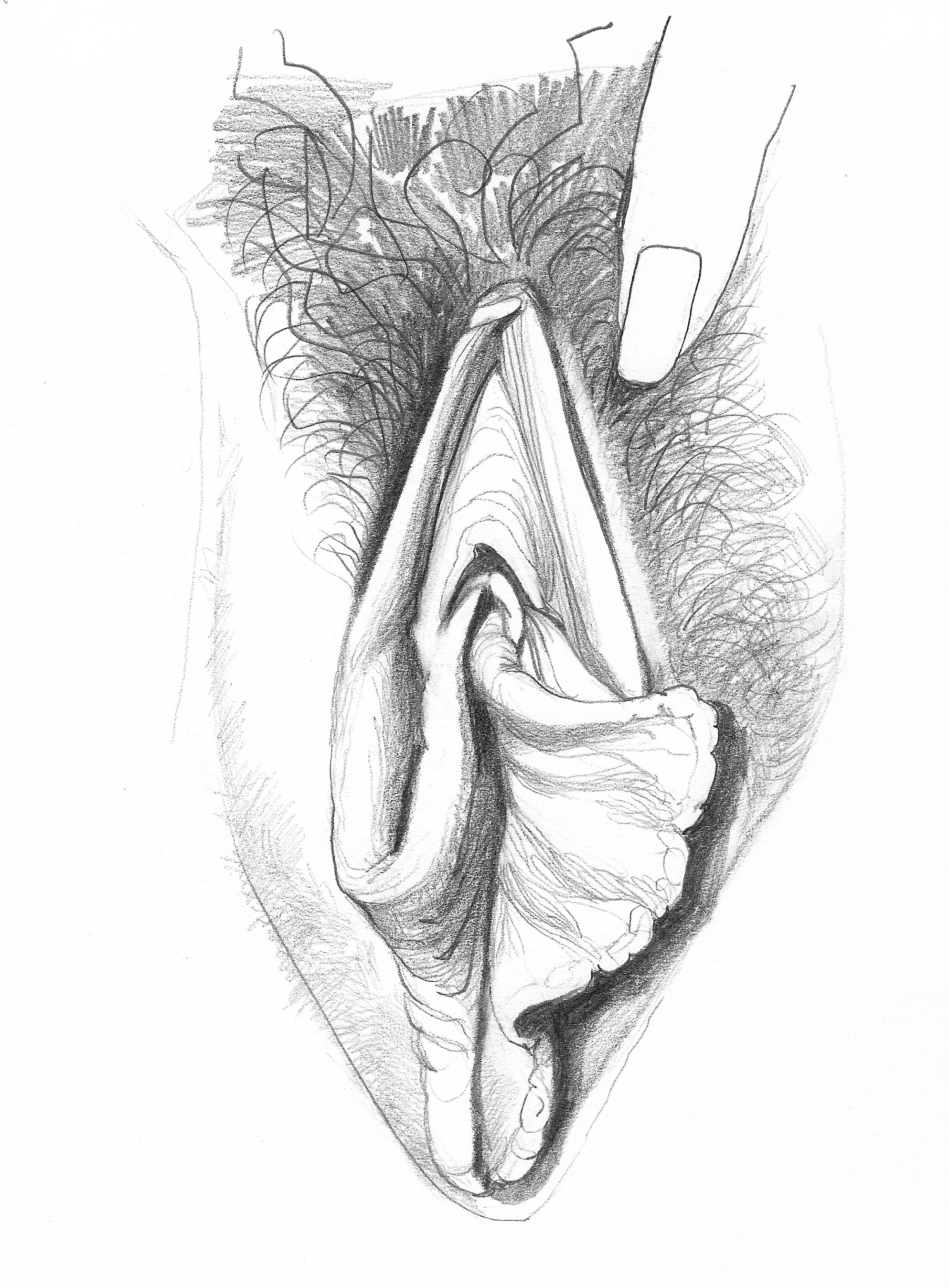 Asymmetrical Labia Vulva.