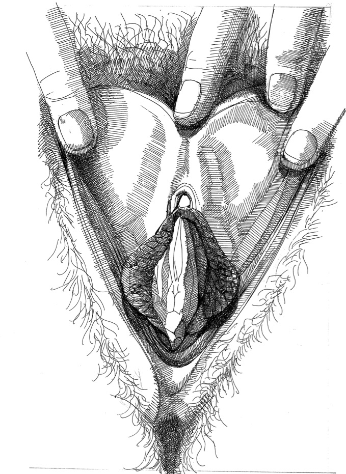 vulva