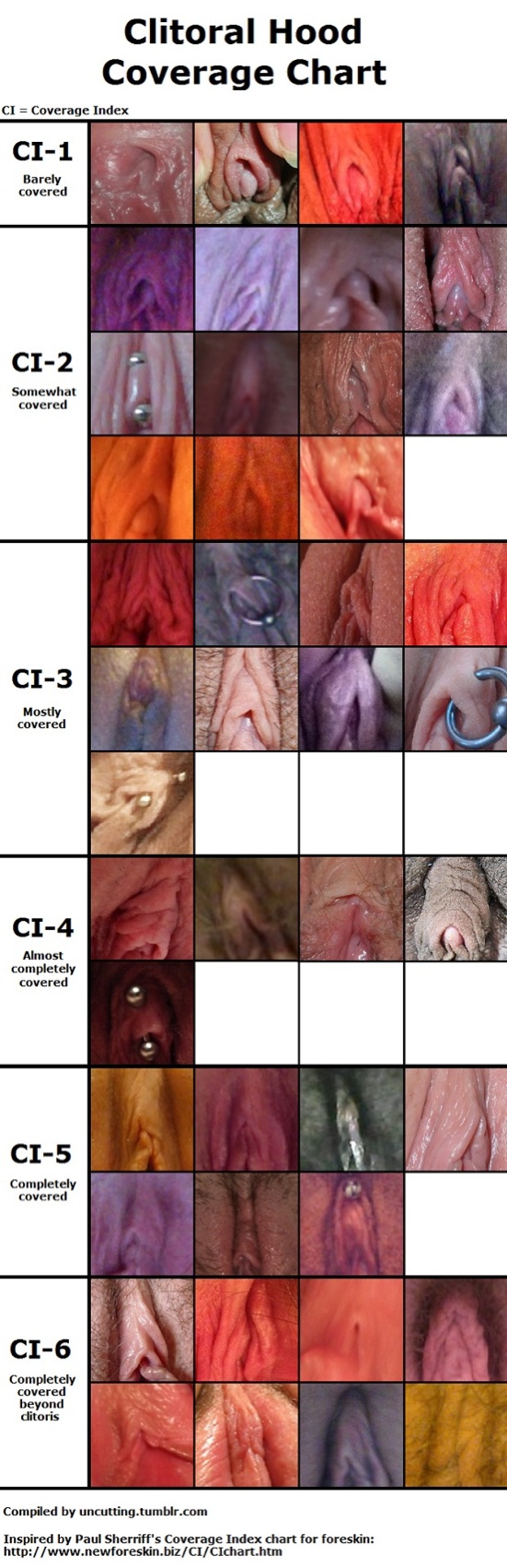 Range of clitoral hoods